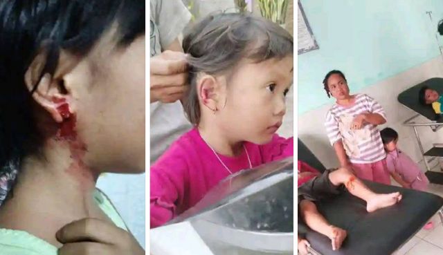 Teror Anjing Gila di Penukal. Beberapa Anak jadi Korban