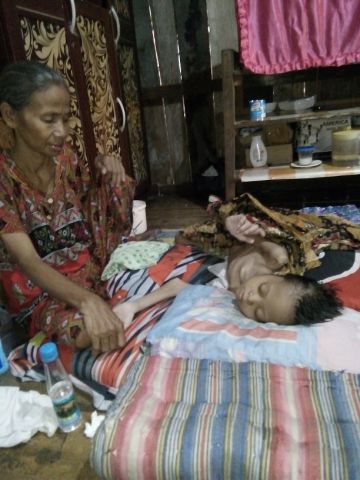 Menderita Kanker Tulang, Gadis ini Sudah Terbaring Selama 7 Tahun